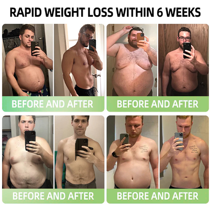 【Only 8 left!】 🛒 Get an extra 30% off now! 🎉Tested by weight loss experts, alternating 4-6 pairs will help you achieve your ideal shape. 🎁Don’t miss out—this offer won’t be back for another year! Grab this limited-time deal now! 🎉